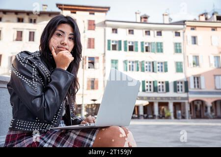 Une adolescente avec vitiligo utilise son ordinateur portable et a une expression réfléchie Banque D'Images