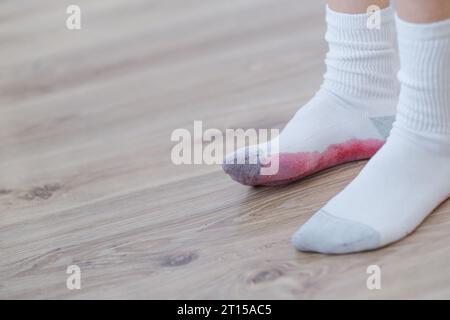 Taches de baies sales sur les vêtements blancs. Une personne méconnaissable marchant sur le sol sale et souillant ses chaussettes blanches. concept de coloration de la vie quotidienne Banque D'Images