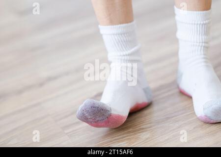 Taches sales de jus renversé sur les chaussettes blanches. concept de coloration de la vie quotidienne. Banque D'Images