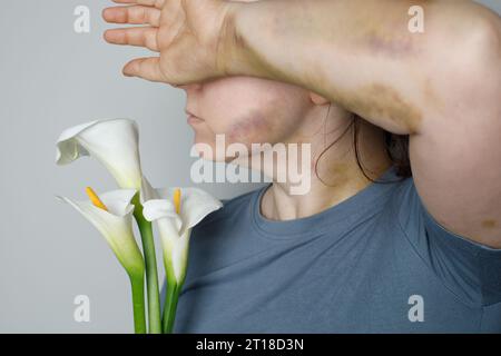 Portrait en gros plan d'une femme avec cicatrice d'accident de voiture et ecchymose Banque D'Images