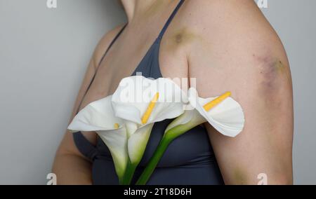 Femme avec cicatrice d'accident de voiture en gros plan Banque D'Images