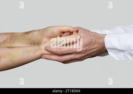 Patient avec ecchymoses et gros plan de la main du médecin. Soutien aux victimes de violence domestique Banque D'Images