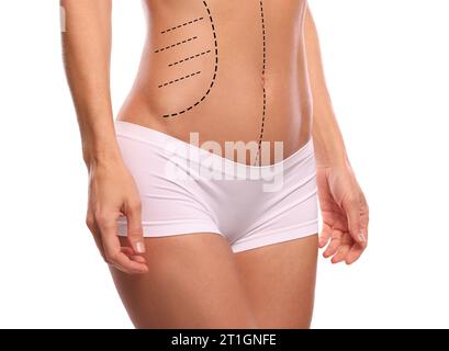 Femme avec des marques pour la chirurgie esthétique sur son abdomen sur fond blanc, gros plan Banque D'Images