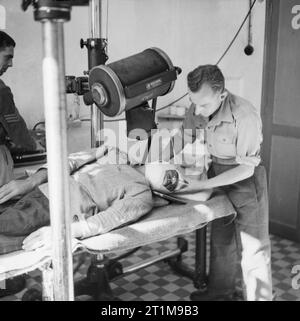 L'Armée britannique en Afrique du Nord 1943 UN SOLDAT subissant une radiographie avant la chirurgie plastique au NO4 Unité de Chirurgie Maxillo-Facial, au 34e hôpital général à Alger, 4 novembre 1943. Banque D'Images