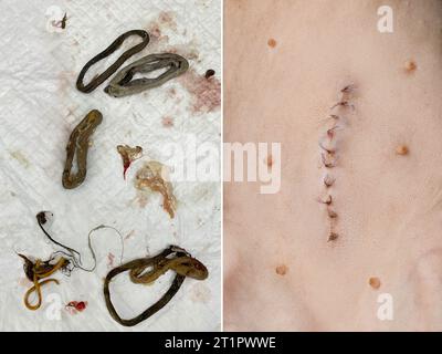 Blocage intestinal du chat. Contenu intestinal et gros plan cicatriciel de suture Banque D'Images