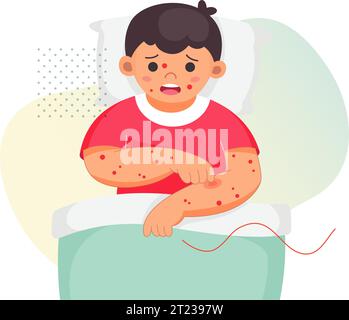 Enfant au lit avec Chickenpox - Illustration stock comme fichier EPS 10 Illustration de Vecteur