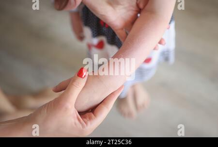 Femme examinant une éruption rouge sur les bras de l'enfant, irritation sur le corps des filles Banque D'Images