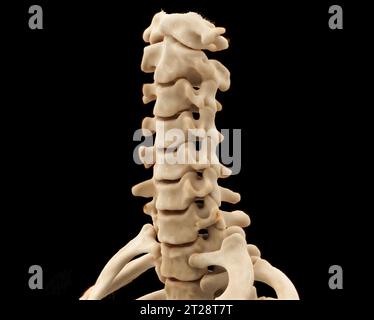 CT scan du rachis cervical ou cervical rendu 3D pour le diagnostic de fracture du rachis cervical en cas de traumatisme. Banque D'Images