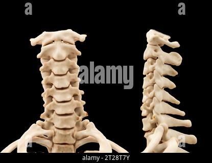 CT scan du rachis cervical ou cervical rendu 3D pour le diagnostic de fracture du rachis cervical en cas de traumatisme. Banque D'Images