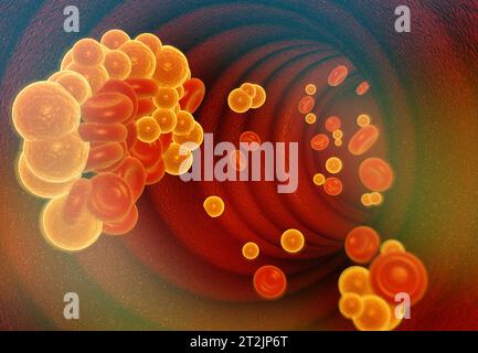 Cholestérol dans les vaisseaux sanguins. illustration 3d. Banque D'Images