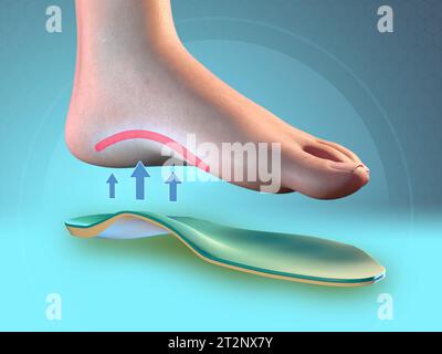 Semelle intérieure soutenant la voûte plantaire. Illustration numérique, rendu 3D. Banque D'Images