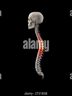 Colonne vertébrale humaine douloureuse dans la région thoracique Banque D'Images