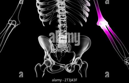 3d rendu illustration d'une anatomie humaine avec douleur au coude Banque D'Images