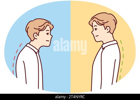 Comparaison de l'homme avec la bonne et mauvaise posture de dos. Les hommes souffrent de scolisose du travail sédentaire. Illustration vectorielle. Illustration de Vecteur