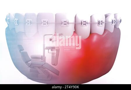 Dent humaine avec appareil orthodontique. implant dentaire. illustration 3d. Banque D'Images