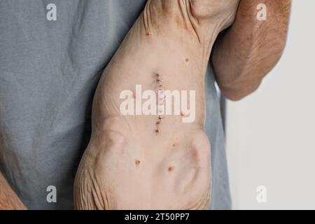 Cicatrice de suture après chirurgie ou stérilisation. Gros plan de l'estomac de chat Banque D'Images