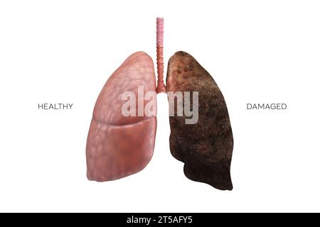 Poumons illustration 3D - partie de Human Organic. Compression saine et endommagée. Banque D'Images