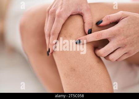 Jeune femme blonde pointant vers un hématome dans la chambre Banque D'Images