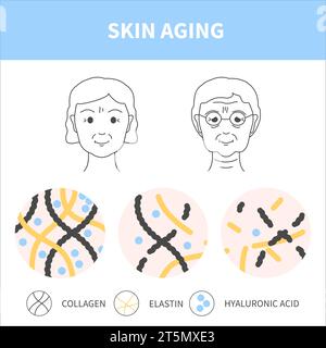 Illustration du diagramme de vieillissement de la peau féminine et de perte de collagène Illustration de Vecteur