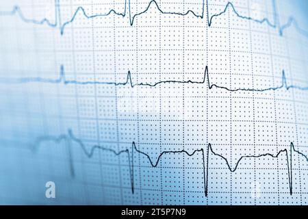 Électrocardiogramme montrant le pouls du cœur humain Banque D'Images