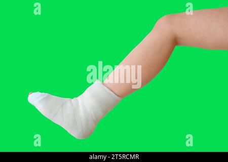 Jambe cassée sur un fond vert dans un plâtre. Ecchymose ou fracture de l'os du pied. Scénario de réclamation d'assurance. Blessure, traumatisme, rétablissement, réadaptation Banque D'Images