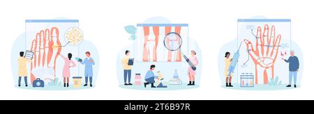 Illustration vectorielle d'ensemble de rhumatologie. Les minuscules personnes examinent les articulations du genou humain, les doigts de la main et du pied, les médecins diagnostiquent la polyarthrite rhumatoïde et l'arthrose, la goutte pour un traitement médical Illustration de Vecteur