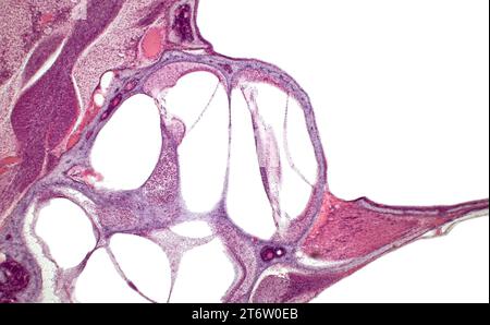 Orgue de Corti (orgue spiralé). Histologie de la cochlée de l'oreille interne. Coloration à l'hématoxyline et à l'éosine. Banque D'Images