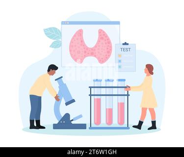 Bilan de santé thyroïdien, illustration vectorielle d'examen endocrinologique. De minuscules endocrinologues examinent les tests sanguins au microscope pour diagnostiquer la maladie thyroïdienne, biopsie en laboratoire par les médecins Illustration de Vecteur