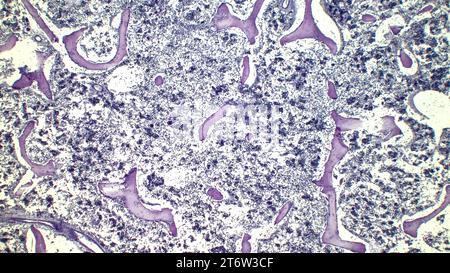 Moelle osseuse rouge humaine, presse hématopoïétique. Les érythrocytes de gros tsit beetveen sont des mégacaryocytes. Coloration à l'hématoxyline et à l'éosine. Banque D'Images