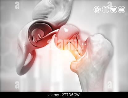 L'arthroplastie de hanche sur le fond médical. illustration 3d. Banque D'Images