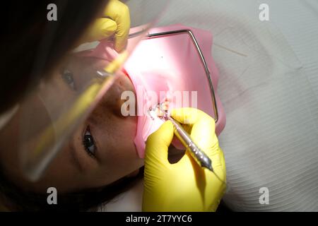 Traitement, nettoyage et blanchiment des dents d'un enfant dans une clinique dentaire. Photo de haute qualité Banque D'Images