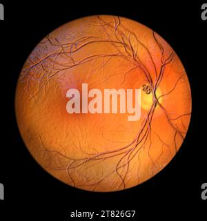 Illustration d'une boucle vasculaire prépapillaire sur la rétine, telle qu'observée lors de l'ophtalmoscopie, montrant les vaisseaux sanguins en boucle autour de l'optique d Banque D'Images