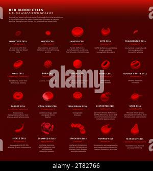 Formes de globules rouges anormaux, illustration Banque D'Images