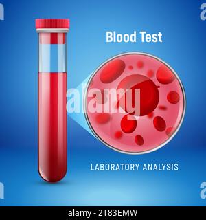 Concept d'hématologie avec tube de globules rouges analyse de laboratoire plat examiner. Hématologie liquide de globules rouges de sang. Illustration de Vecteur