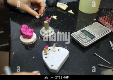 Fabrication de couronnes et de prothèses dentaires en céramique. Scanner des plâtres dentaires. Fabrication de prothèses céramiques en clinique dentaire. CER Banque D'Images