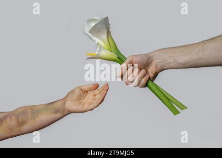 Main mâle avec fleur de lys blanc et main femelle avec ecchymose gros plan sur fond gris. Cicatrice d'accident de voiture, traitement de l'embolie pulmonaire ou domestique Banque D'Images