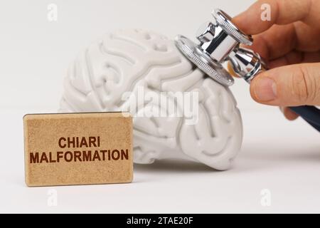 Concept médical. Sur une surface blanche, le cerveau est diagnostiqué à l'aide d'un stéthoscope, à côté de lui se trouve un signe avec l'inscription - malformation de Chiari Banque D'Images