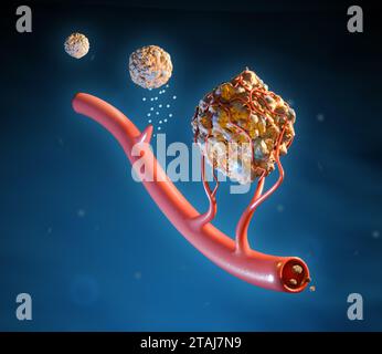 Cellules cancéreuses utilisant l'angiogenèse pour croître et se propager à travers le corps. Illustration numérique, rendu 3D. Banque D'Images