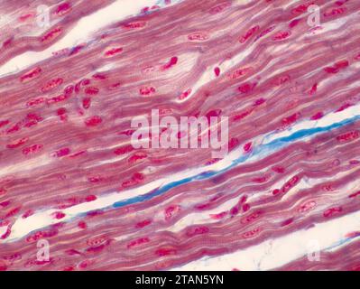 Muscle cardiaque humain, micrographe léger Banque D'Images