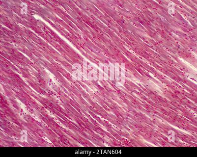 Muscle cardiaque humain, micrographe léger Banque D'Images