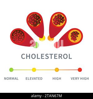 Taux de cholestérol, illustration conceptuelle. Banque D'Images
