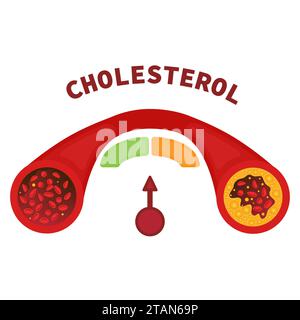 Taux de cholestérol, illustration conceptuelle Banque D'Images