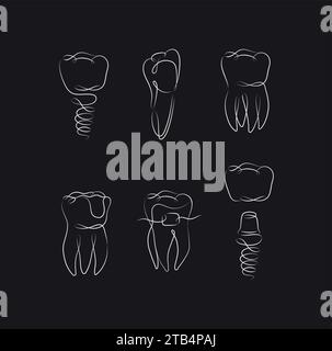 Implant de collecte de dents, accolades, couronne dentaire, dessin de joint dentaire dans un style linéaire sur fond noir Illustration de Vecteur
