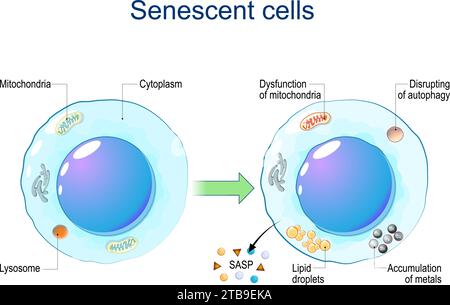 Cellules sénescentes. Sénescence cellulaire par dysfonction des mitochondries, accumulation de métaux, perturbation de l'autophagie, libération de gouttelettes lipidiques Illustration de Vecteur