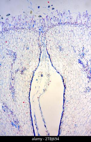 Stigmate avec pollen (Lilium sp.). Microscope optique X40. Banque D'Images