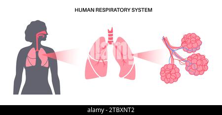 Pneumopathies, illustration Banque D'Images