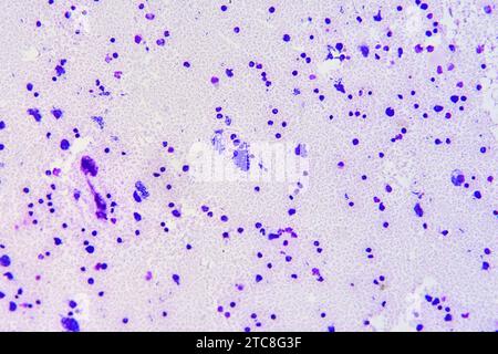 Toxoplasma gondii parasite alveolata toxoplasmose responsable. Microscope optique X200. Banque D'Images