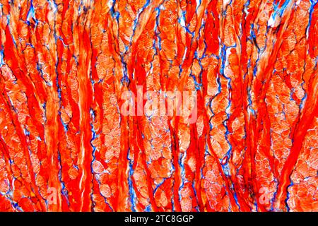 Muscle squelettique en coupe transversale et longitudinale de la langue. Microscope optique X300 à 10 cm de large. Banque D'Images