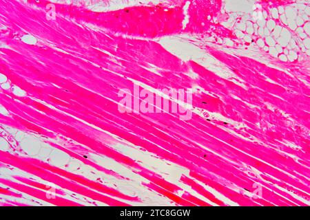 Muscle squelettique de la trachée en coupe longitudinale. Microscope optique X200 à 10 cm de large. Banque D'Images