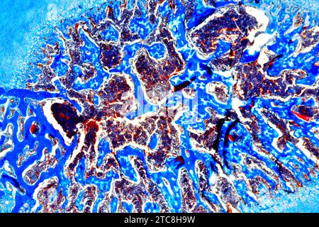 L'os spongieux ou spongieux est un organe hématopoïétique. Microscope optique X40 à 10 cm de large. Banque D'Images